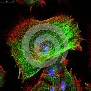 Confocal microscopy of fibroblast cells photo