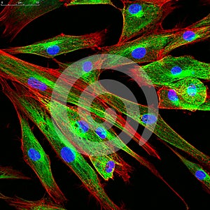 Confocal microscopy of fibroblast cells photo