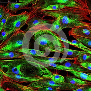 Confocal microscopy of fibroblast cells photo