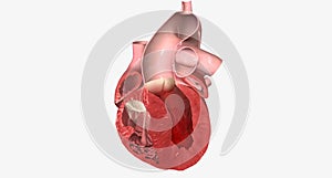 Congestive Heart Failure Left Sided Diastolic
