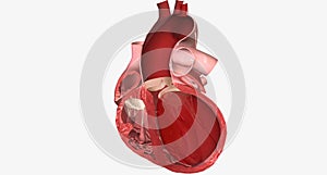 Congestive Heart Failure Left Sided Systolic