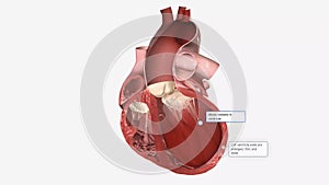 Congestive Heart Failure Left Sided Systolic
