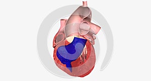 Congestive Heart Failure Right-Sided Diastolic
