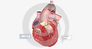 Congestive Heart Failure Right-Sided Diastolic