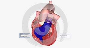 Congestive Heart Failure Right-Sided Diastolic