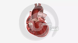 Congestive Heart Failure Right-Sided Diastolic