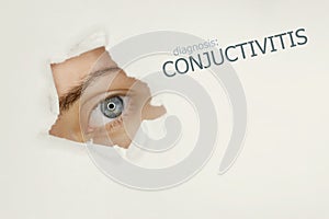 Conjuctivitis disease poster with blue eye on left