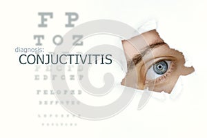 Conjuctivitis disease poster with eye test chart and blue eye.