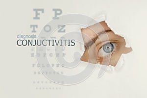 Conjuctivitis disease poster with eye test chart and blue eye on right