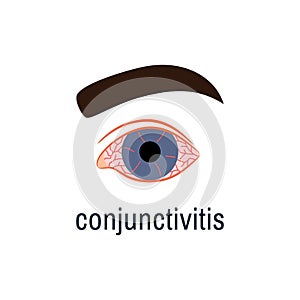 Conjunctivitis icon isolated on white. Watery red eye logo. Viral infection season allergy eye disease virus symptom