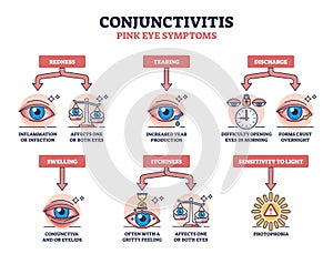 Conjunctivitis or pink eye symptoms with medical examples outline diagram