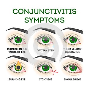 Conjunctivitis symptoms. Pink eye disease, infection and allergy