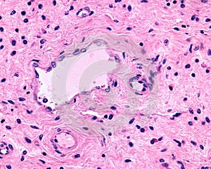 Connective tissue. Venules