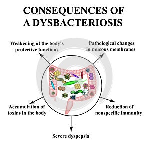 Consequences of intestinal dysbiosis. Dysbacteriosis of the colon Infographics photo