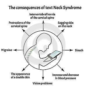 Consequences of Text Neck Syndrome. Spinal curvature, kyphosis, lordosis of the neck, scoliosis, arthrosis. Improper