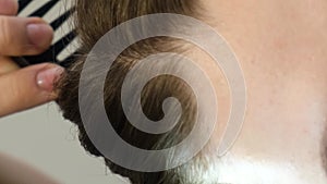 Consultation of a trichologist. A doctor diagnoses a young girl's hair structure using a smartphone