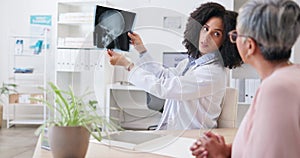 Consulting, doctor and senior woman with mri results in a hospital for brain and head injury. Talking, healthcare and