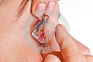 Contact lens