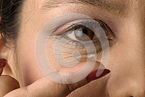 Contact Lens