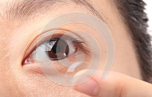 Contact lens