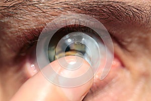 Contact lens