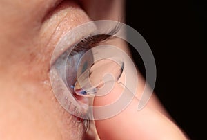 Contact lens on eye placement