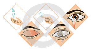 Contact lens infographic. Instruction how to put on lenses. 5 steps wash your hands, take a lens, check the position of