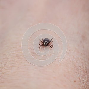 contagious insect a tick crawling on human skin