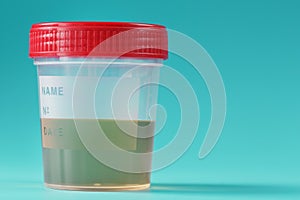 A container for biomaterials with a urine analysis and a red lid on a cyanic background