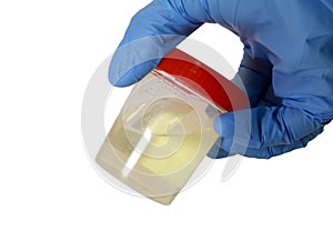 Container for urinalysis in the hand of the doctor photo