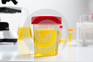 Container with urine sample for analysis on table