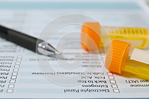 Containers with urine samples for analysis on medical report, closeup.