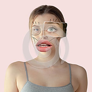 Contemporary art collage. Young woman with drawn lines on face preparing for plastic surgery, beauty injections