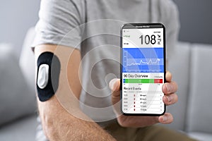 Continuous Glucose Blood Sugar Test