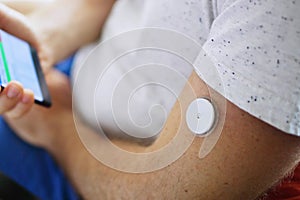 Continuous Glucose Monitoring System for Diabetic Man photo