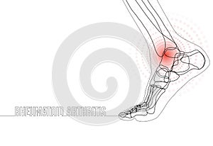 Continuous line drawing concept banner about Rheumatoid arthritis