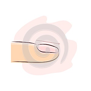 convex nail plate type, nail growth direction, curvature, vector illustration