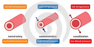 Cooling cause vasoconstriction and increase blood pressure. heat cause vasodilation and decrease blood pressure. Health care photo