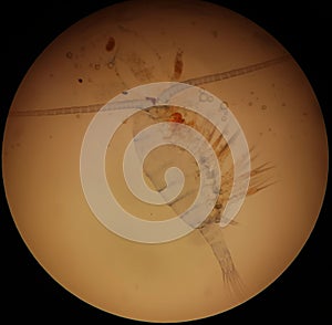 A copepod under a microscope