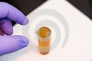 Coproparazitological examination by flotation method