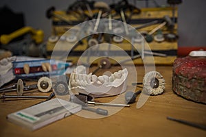 A copy of a human tooth cast in plaster