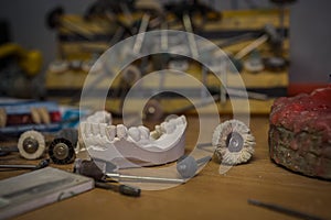 A copy of a human tooth cast in plaster