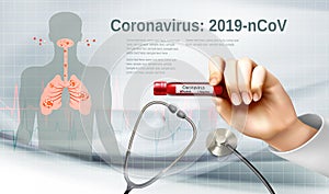 Coranavirus background with doctor holding tube with pasitiv test photo