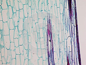 Corn stem micrograph