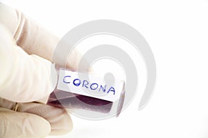 Corona blood test