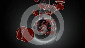 Corona virus cells in blood stream under electron microscope