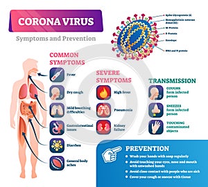 Corona virus COVID-19 outbreak important information, vector illustration infographic