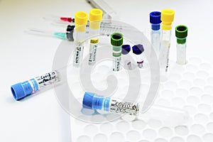 Corona virus and Covid-19 positive test samples. Diagnosis and laboratory. Studio shoot, white background