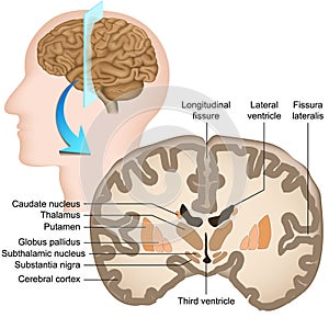 Coronal section of the human brain medical  illustration