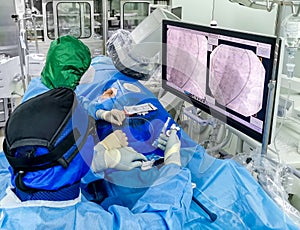 Coronary angioplasty in COVID pandemic photo
